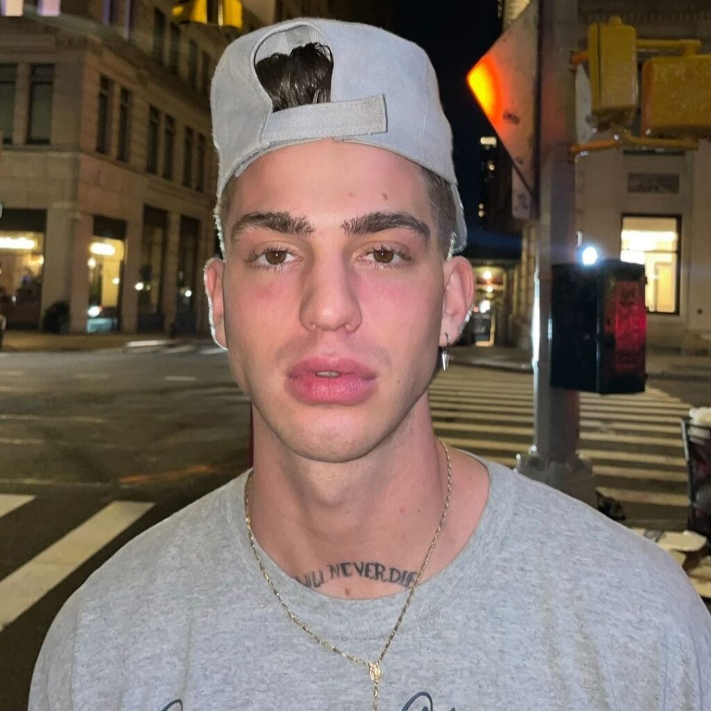 de que murio el modelo jeremy roehlemann